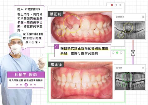 牙齒面向